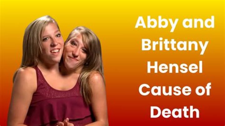 Understanding the Life and Legacy of Abby and Brittany Hensel: What is the Cause of Death?