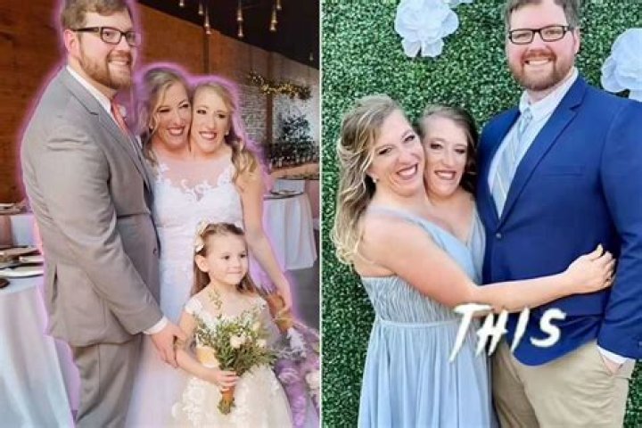 Brittany and Abby Hensel Wedding: A Unique Celebration of Love and Unity