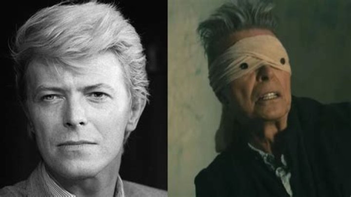 David Bowie's Cause of Death: Unveiling the Truth