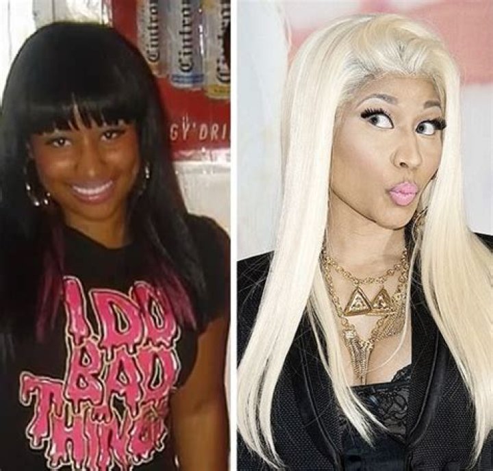 Did Nicki Minaj Bleach Her Skin? Uncovering the Truth Behind the Controversy
