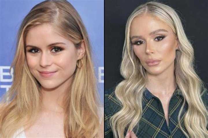 Erin Moriarty Plastic Surgery: The Truth Behind Her Transformation in The Boys