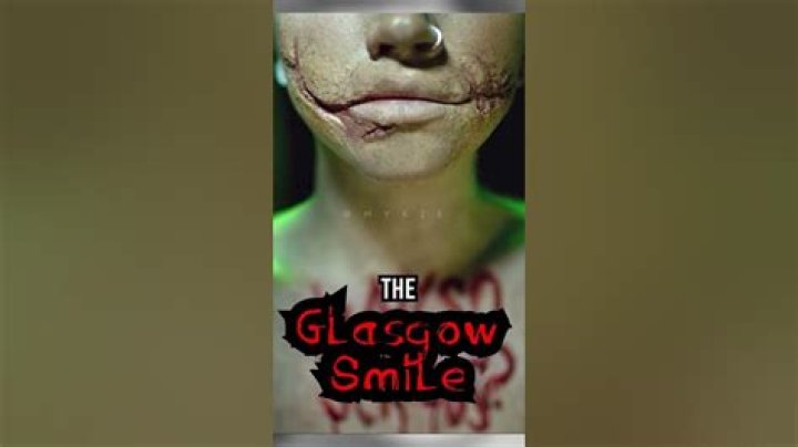 Glasgow Smile Origin: Unveiling the Fascinating History Behind the Iconic Smile