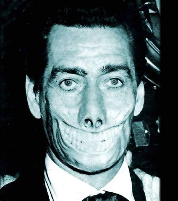 Glasgow Smile Real: Unveiling the Authenticity and History Behind the Iconic Look