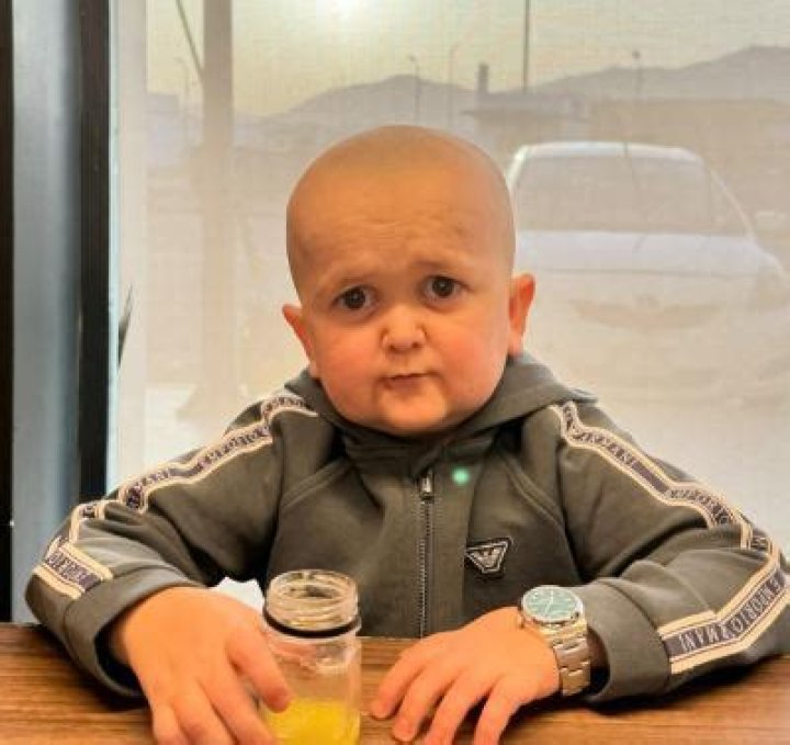 Understanding Hasbulla Syndrome: A Comprehensive Guide