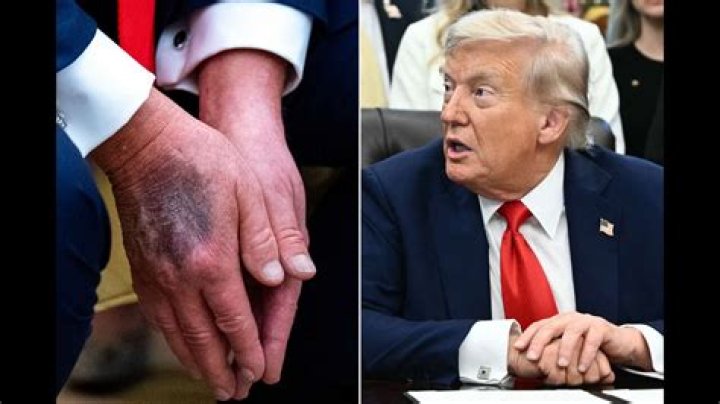 Is Donald Trump Dead? Unraveling the Truth Behind the Rumors