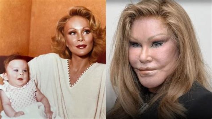 Unveiling the Intriguing Life of Jocelyn Wildenstein Before Surgery