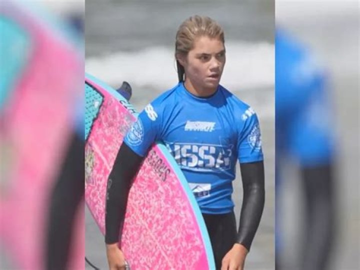 Kai Thompson Surfer Accident: The Untold Story and Lessons Learned