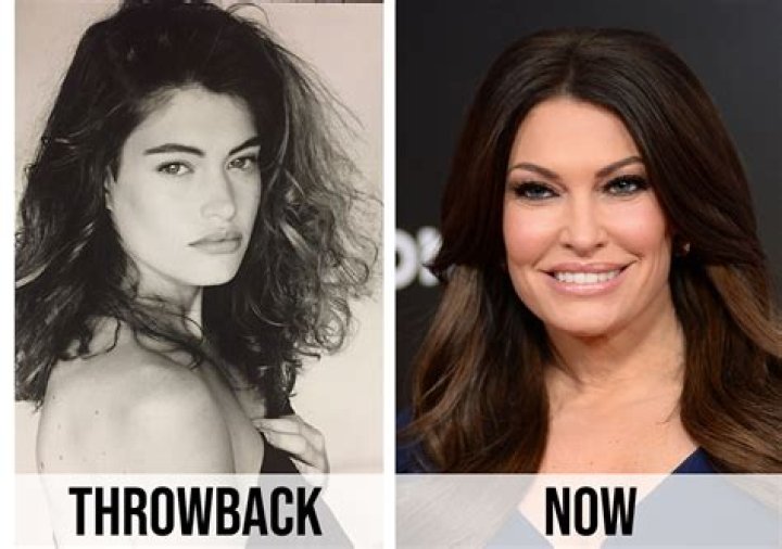 Beauty and Transformation: The Story Behind Kimberly Guilfoyle's Plastic Surgery