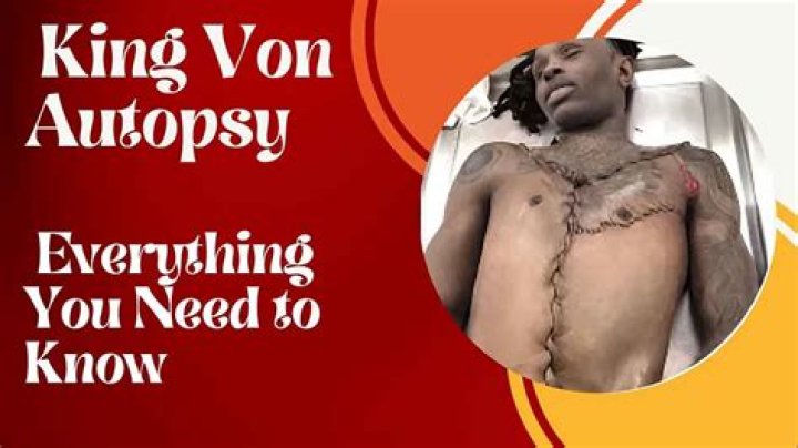 Unveiling the Truth: King Von Autopsy Results and Legacy