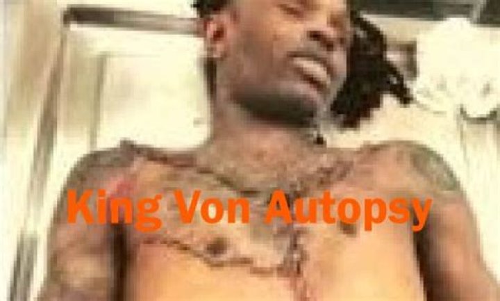 Unraveling the Mystery: King Von's Autopsy Results