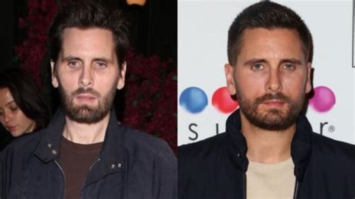 Scott Disick's Ozempic Face Transformation: Unveiling the Truth Behind the Trend
