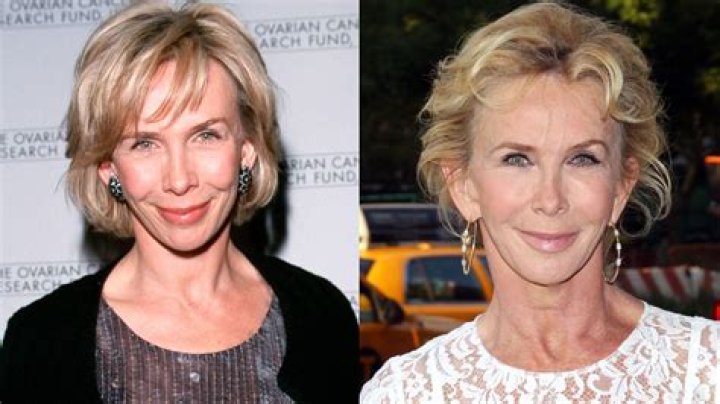 Trudie Styler Plastic Surgery: Exploring the Truth Behind the Rumors