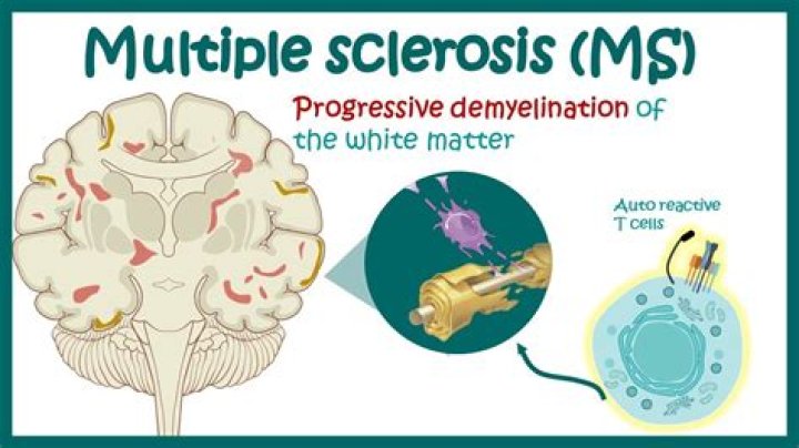 What Does Ms Foxy Do? Exploring the Multifaceted Career and Persona