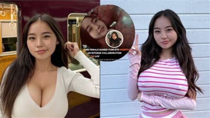 Heartfelt Concerns: Yumi Eto Hospitalized